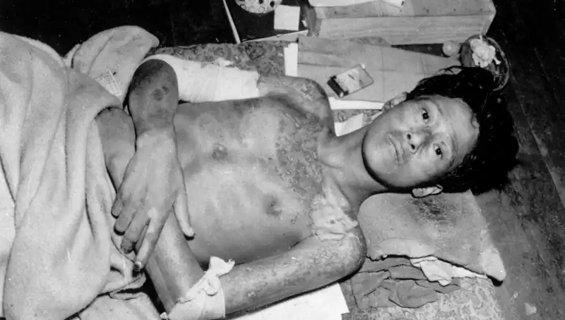 80 Yıl Sonra Nagasaki'den Gelen Uyarı: Nükleer Felaket Tehlikesi Artıyor